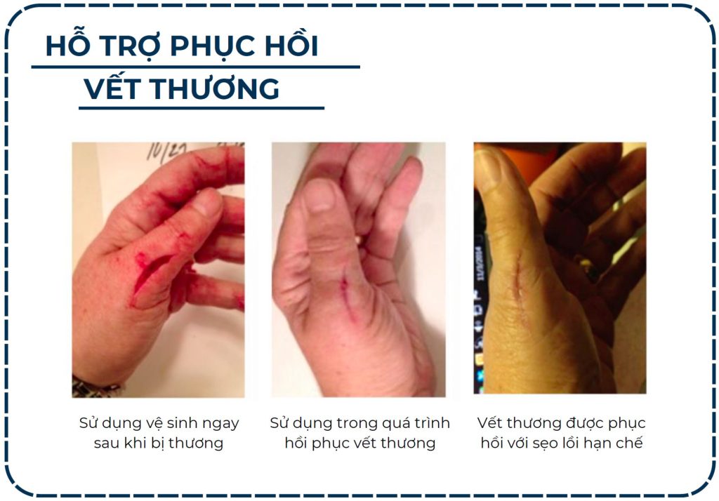 HỖ TRỢ PHỤC HỒI VẾT THƯƠNG